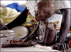 Starving child in Niger